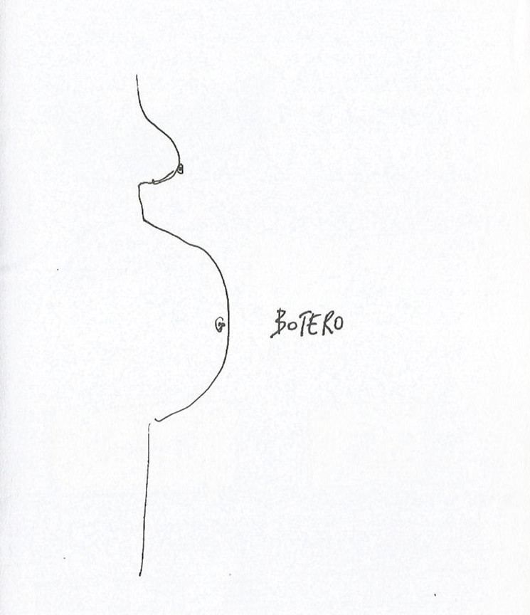 Botero – Mogg, foto 6 di 7